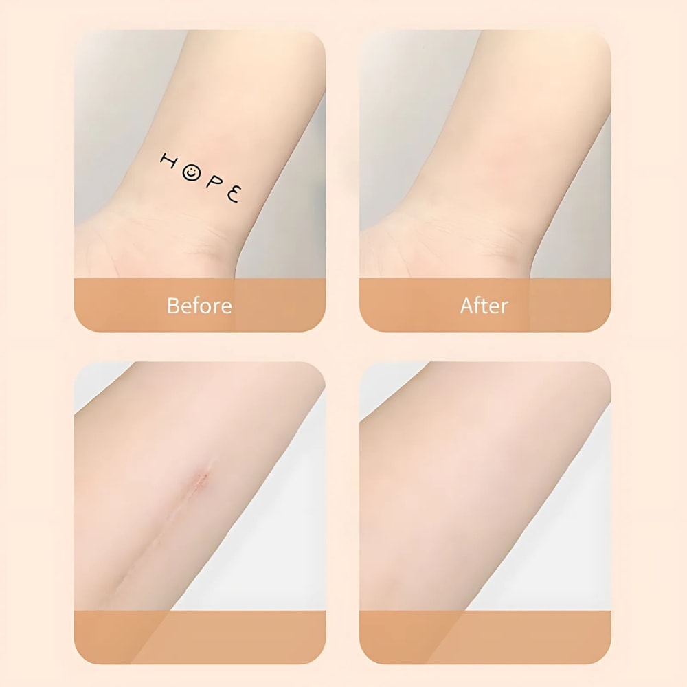 Waterproof Scar and Tattoo Concealer Patch Skin Tone Cover Tape